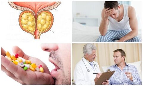 prostatitída u mužov