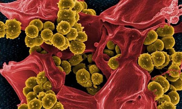 Staphylococcus aureus ako príčina bakteriálnej prostatitídy